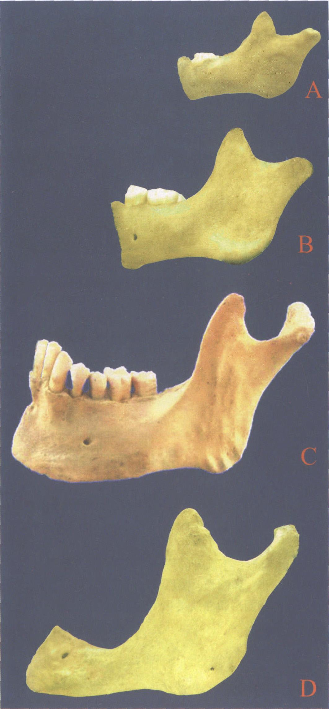 图2-21 下颌骨年龄变化