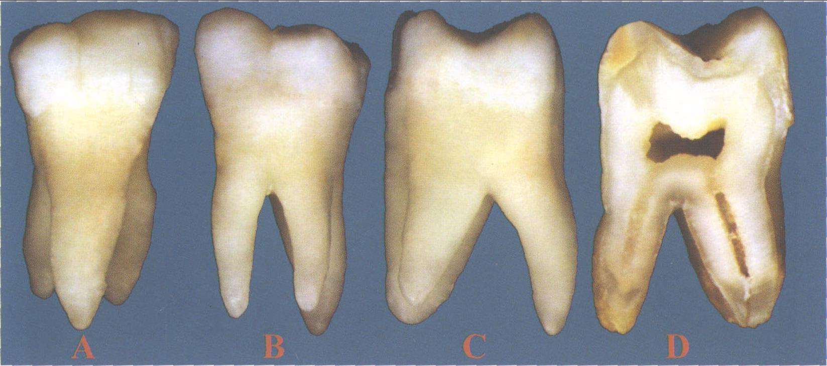 下颌磨牙解剖形态图谱图片