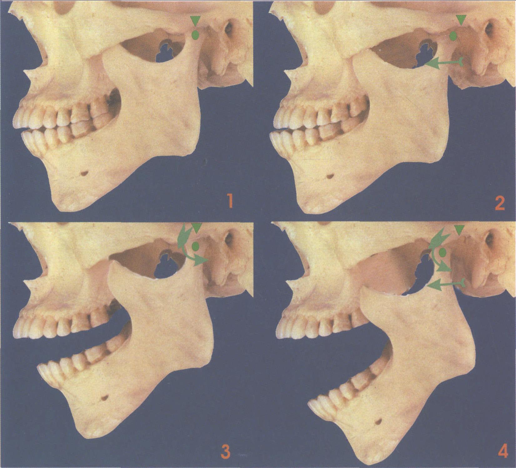 39.下颌骨 (外侧面观)-系统解剖学-医学