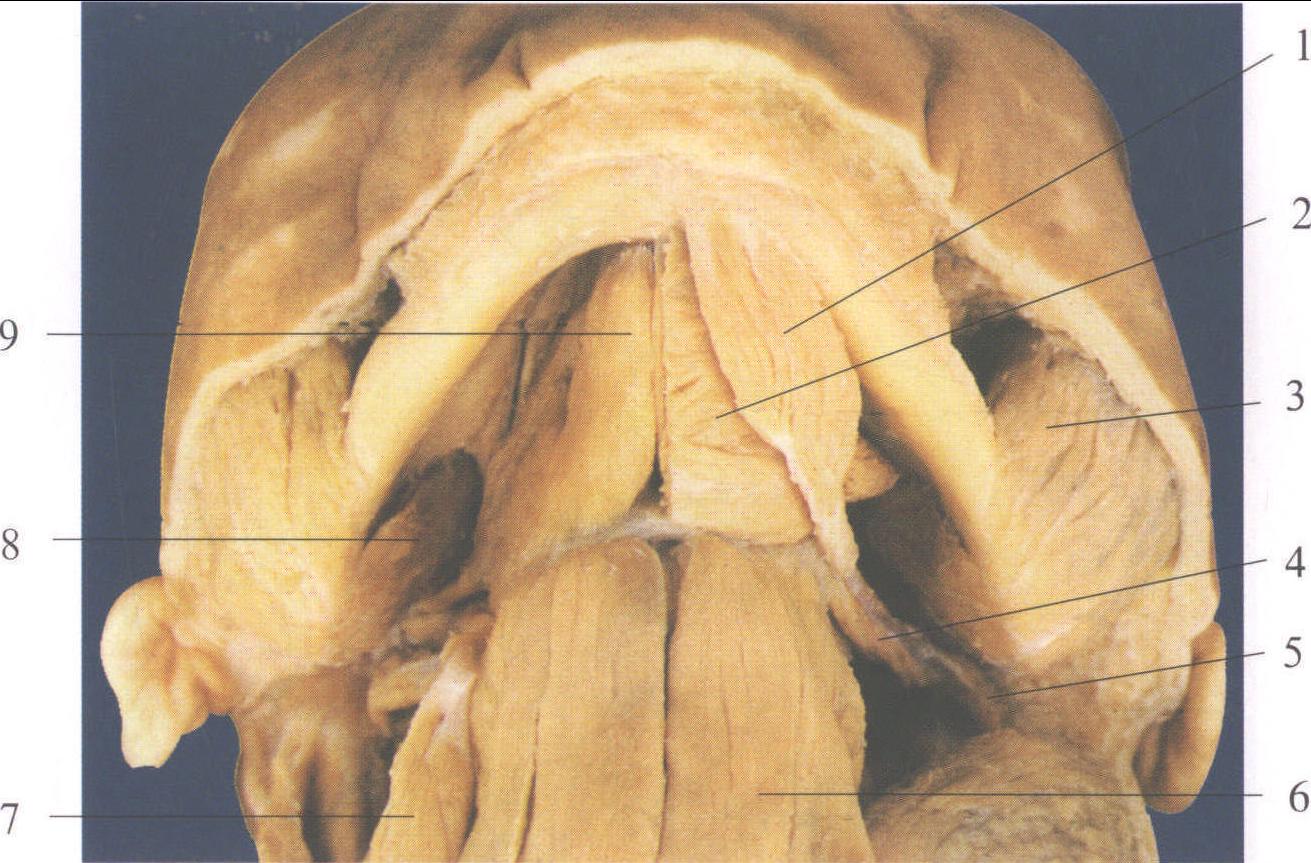 图5-128 口底肌(1)