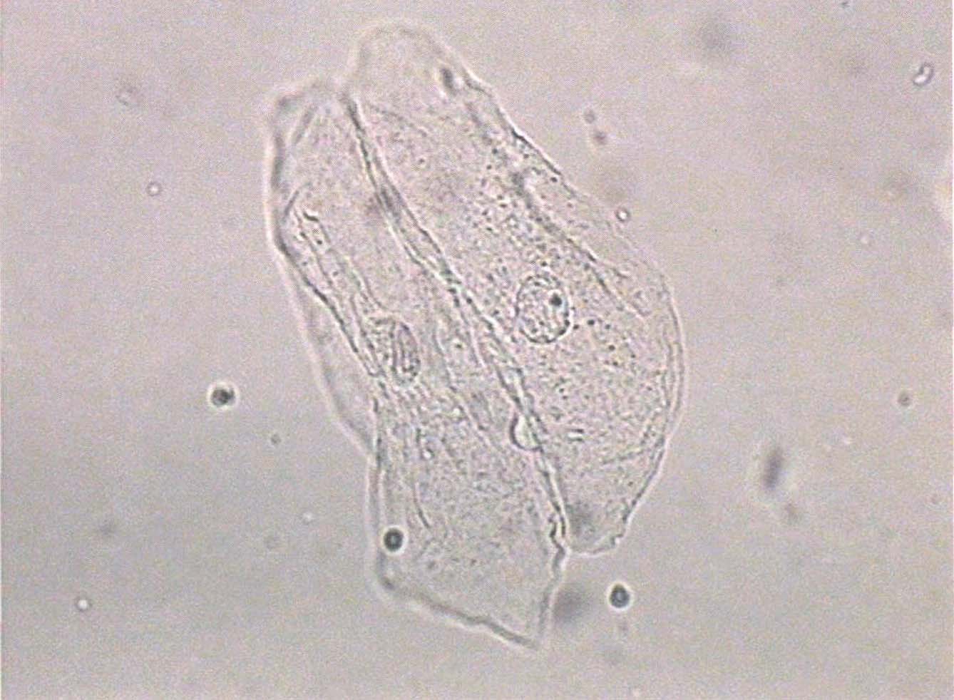 图3-3-5 (未染色)鳞状上皮细胞