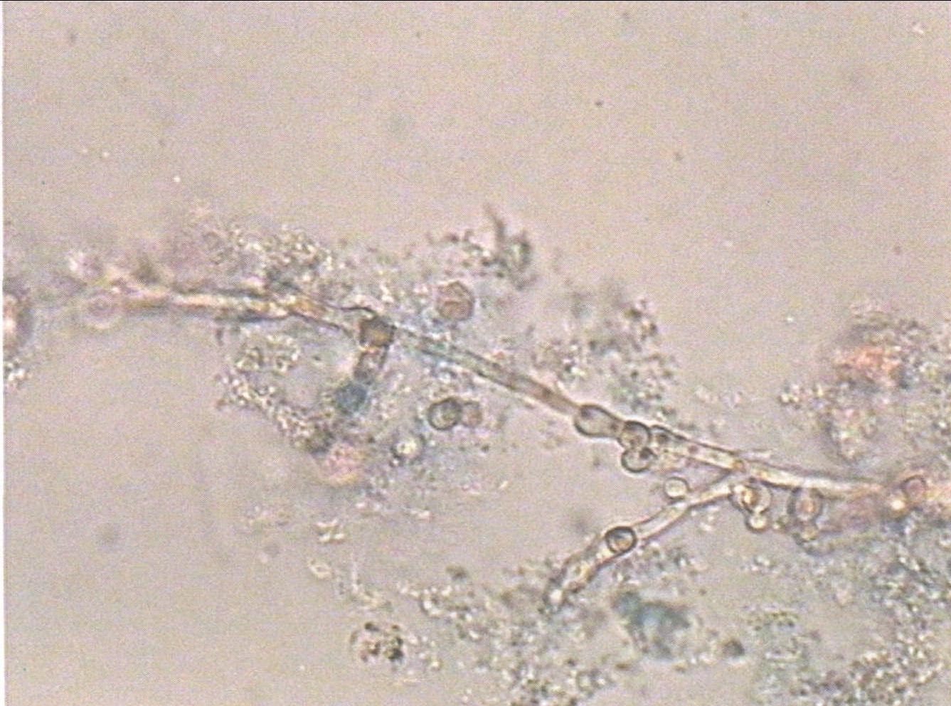 图3-6-29 真菌菌丝