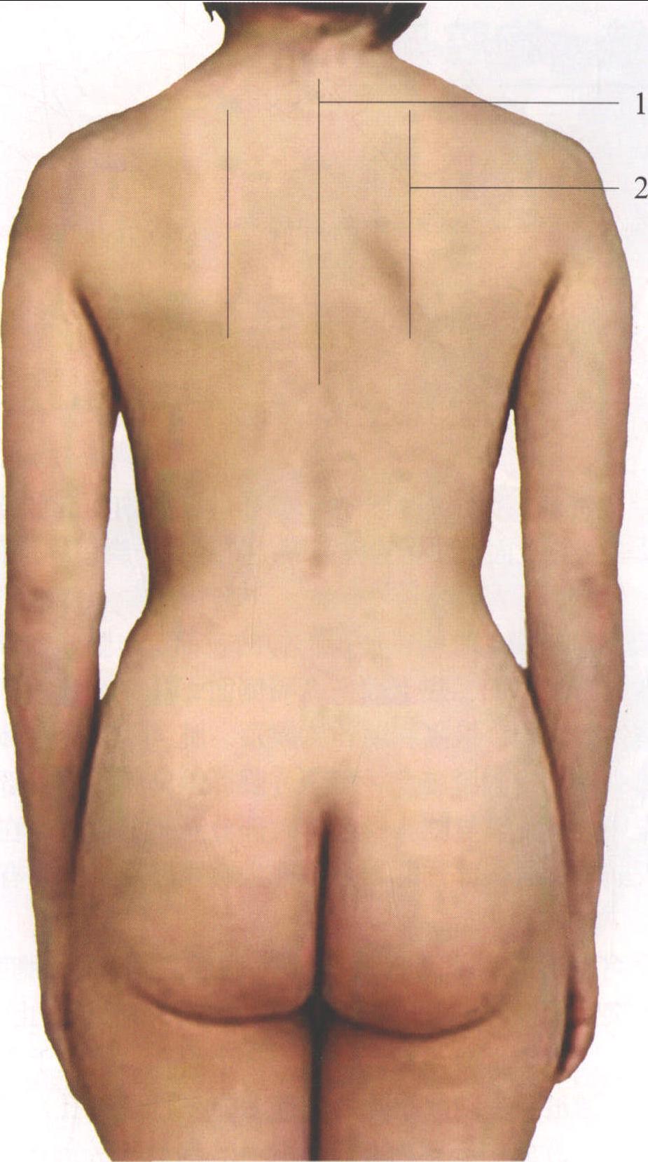 图1-2 胸部的表面解剖 (后面)