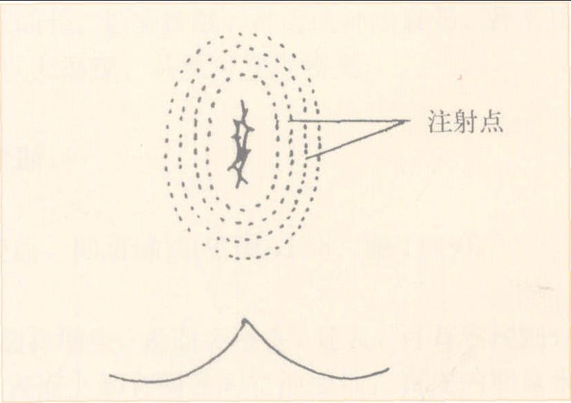 7 肛周瘙癢癥