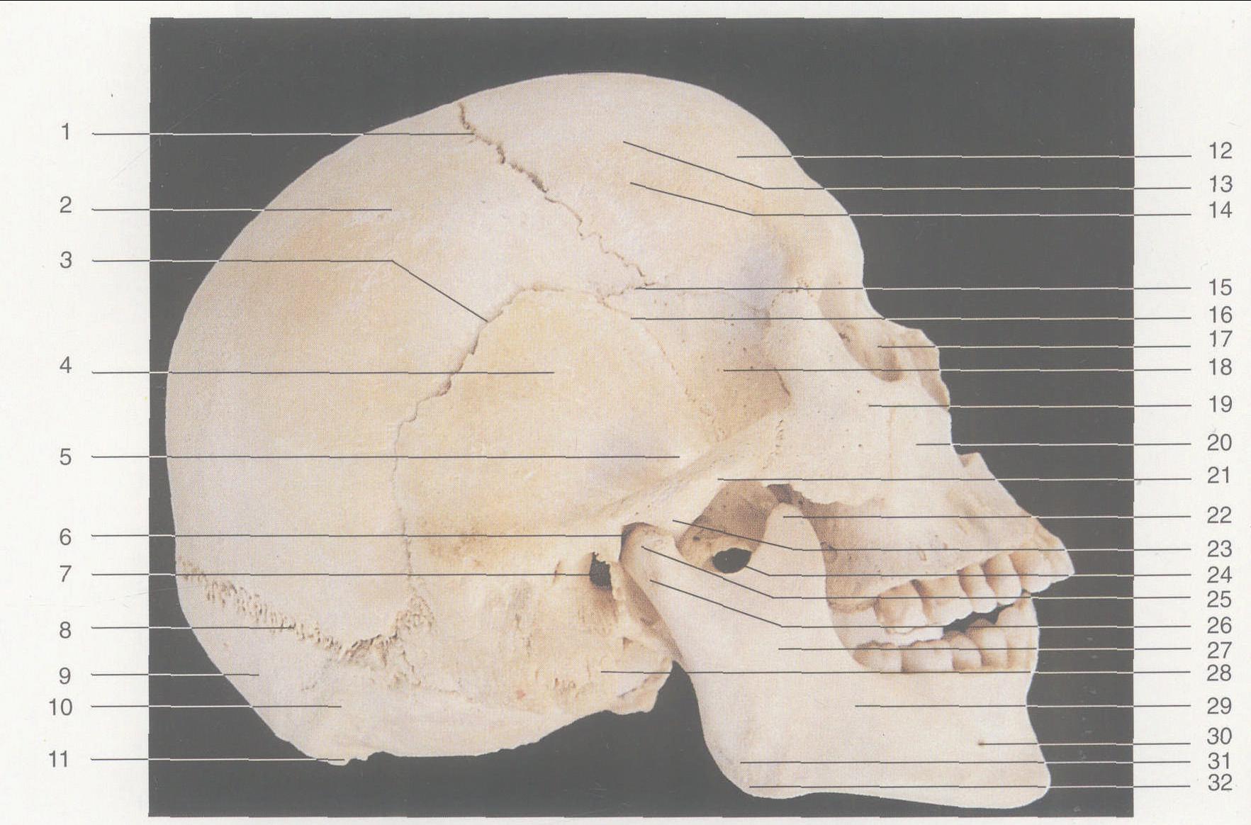 图1—9 颅骨 (侧面观)