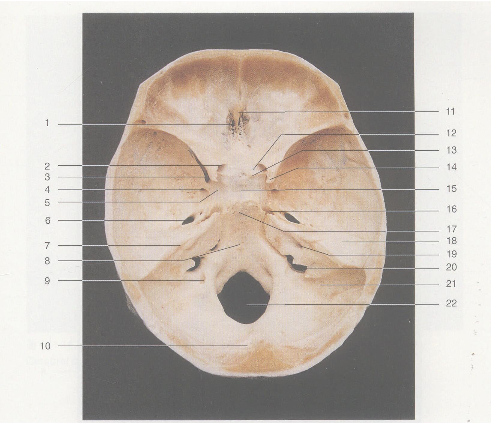 图1—12 颅底结构 (内面观)