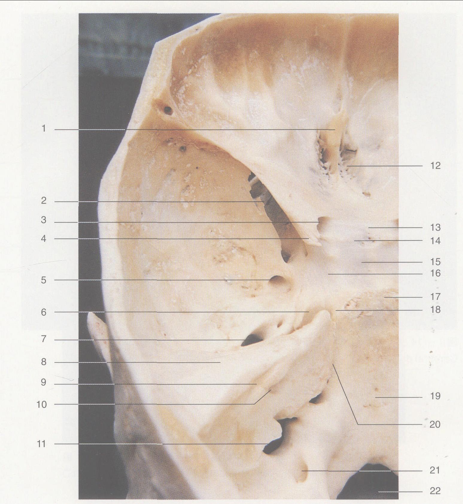 图1—15 颅底骨性A结构 (上面观)