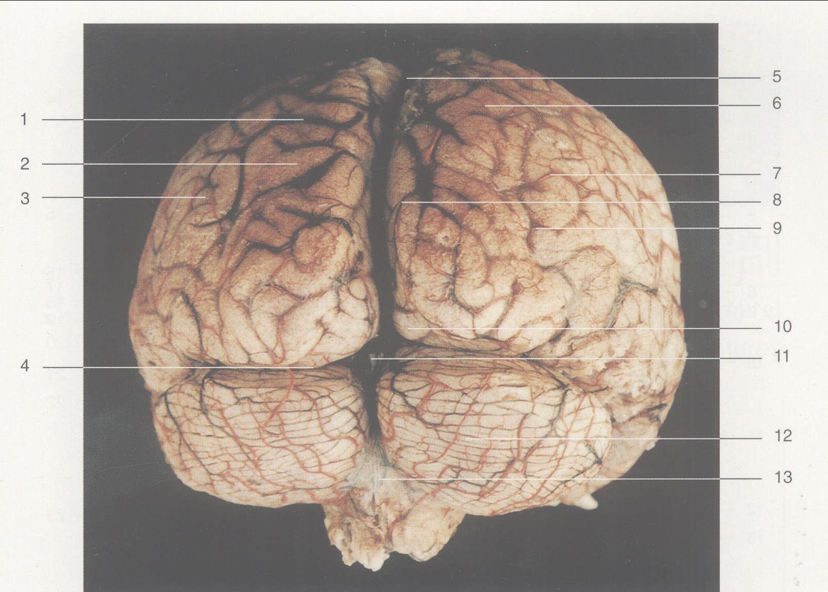 图1—22 脑组织后面观