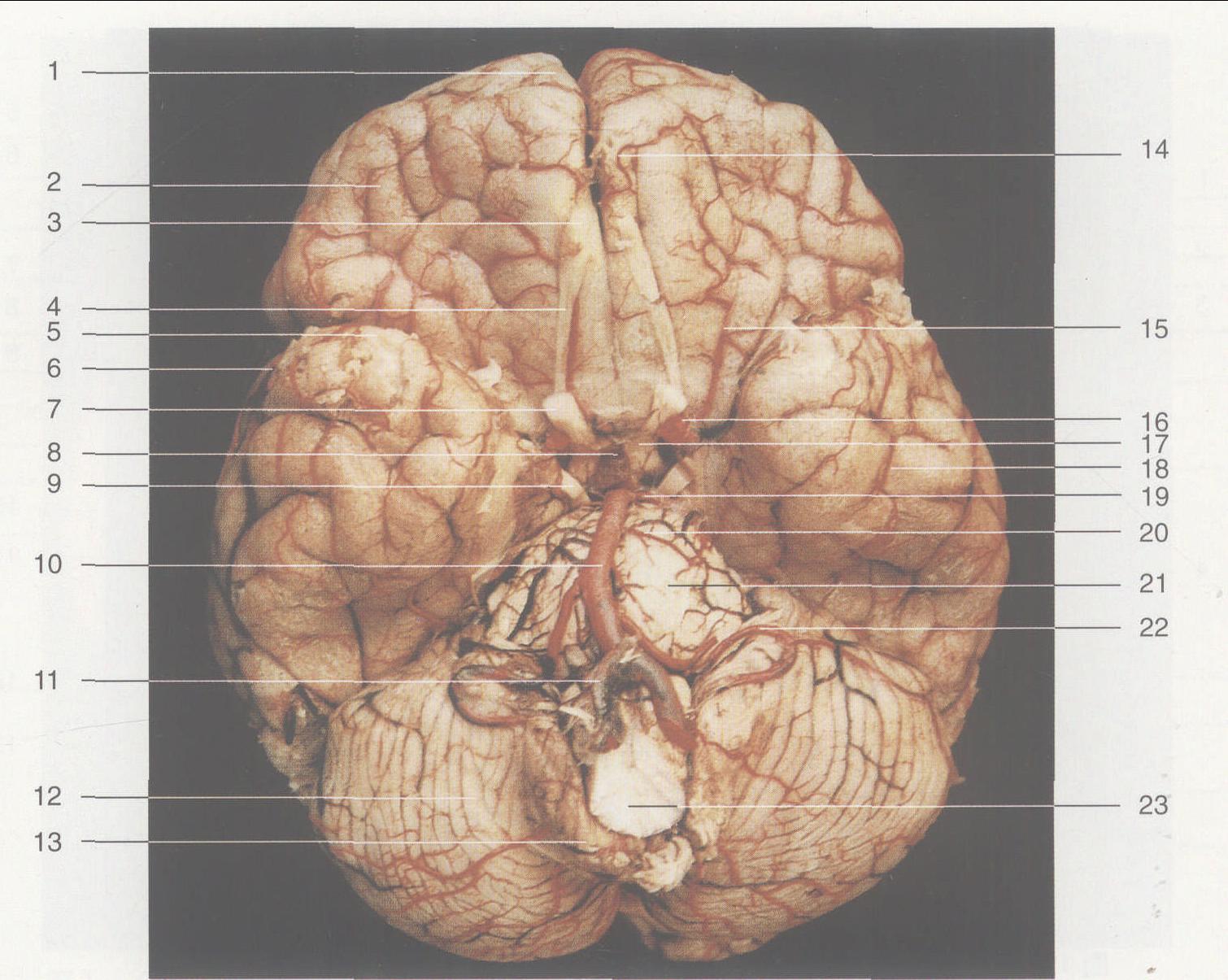 图1—23 脑组织底面观