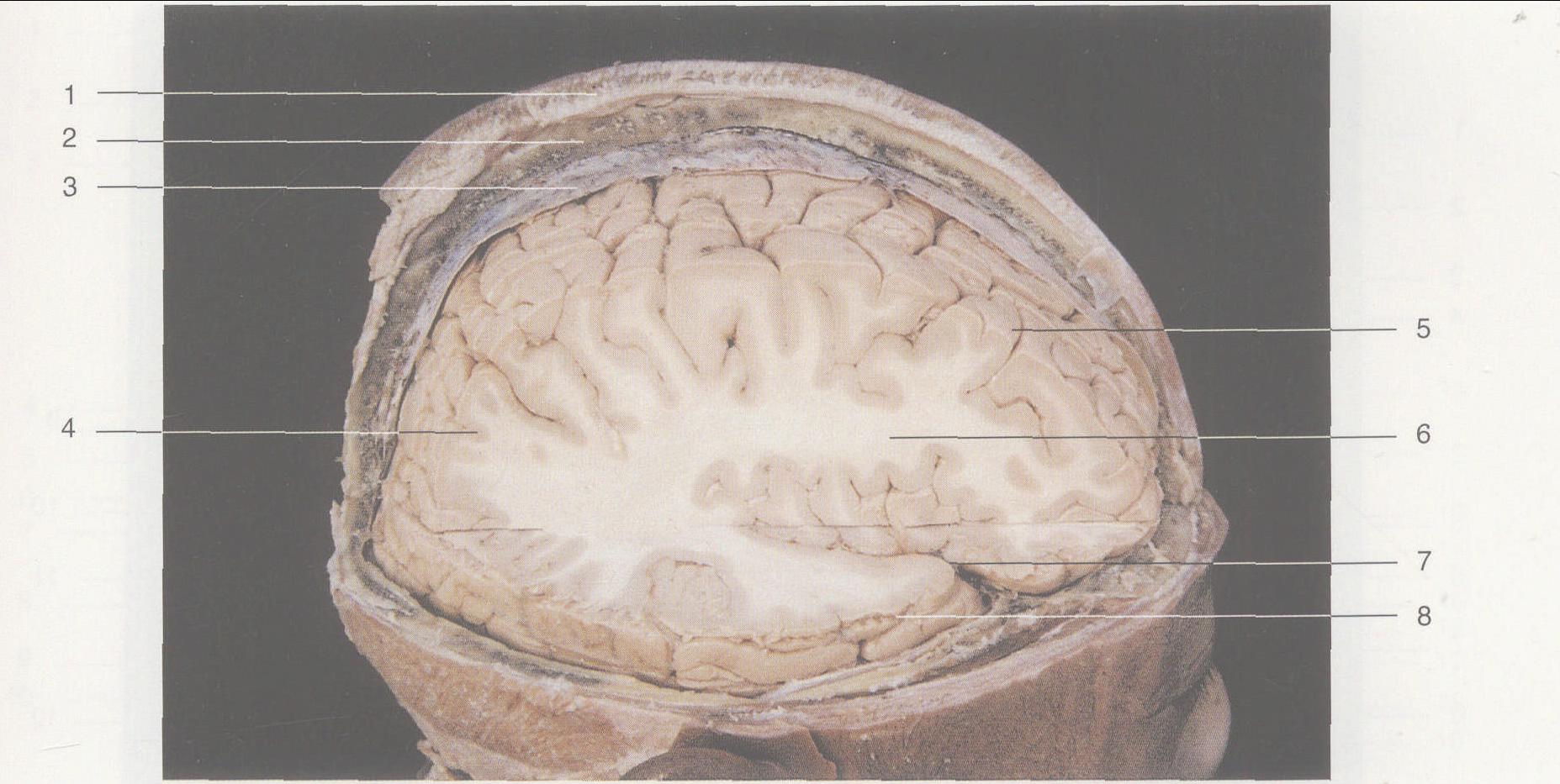 图2—2 脑内结构 (侧面观)