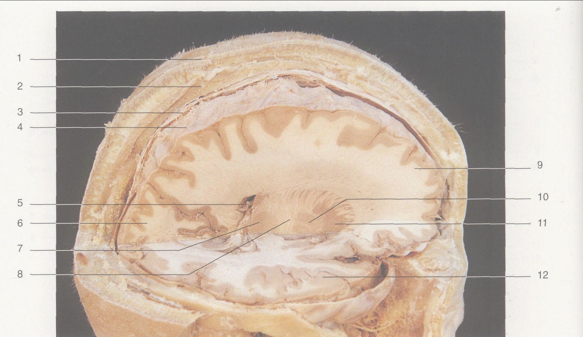 图2—3 脑内结构 (侧面观)