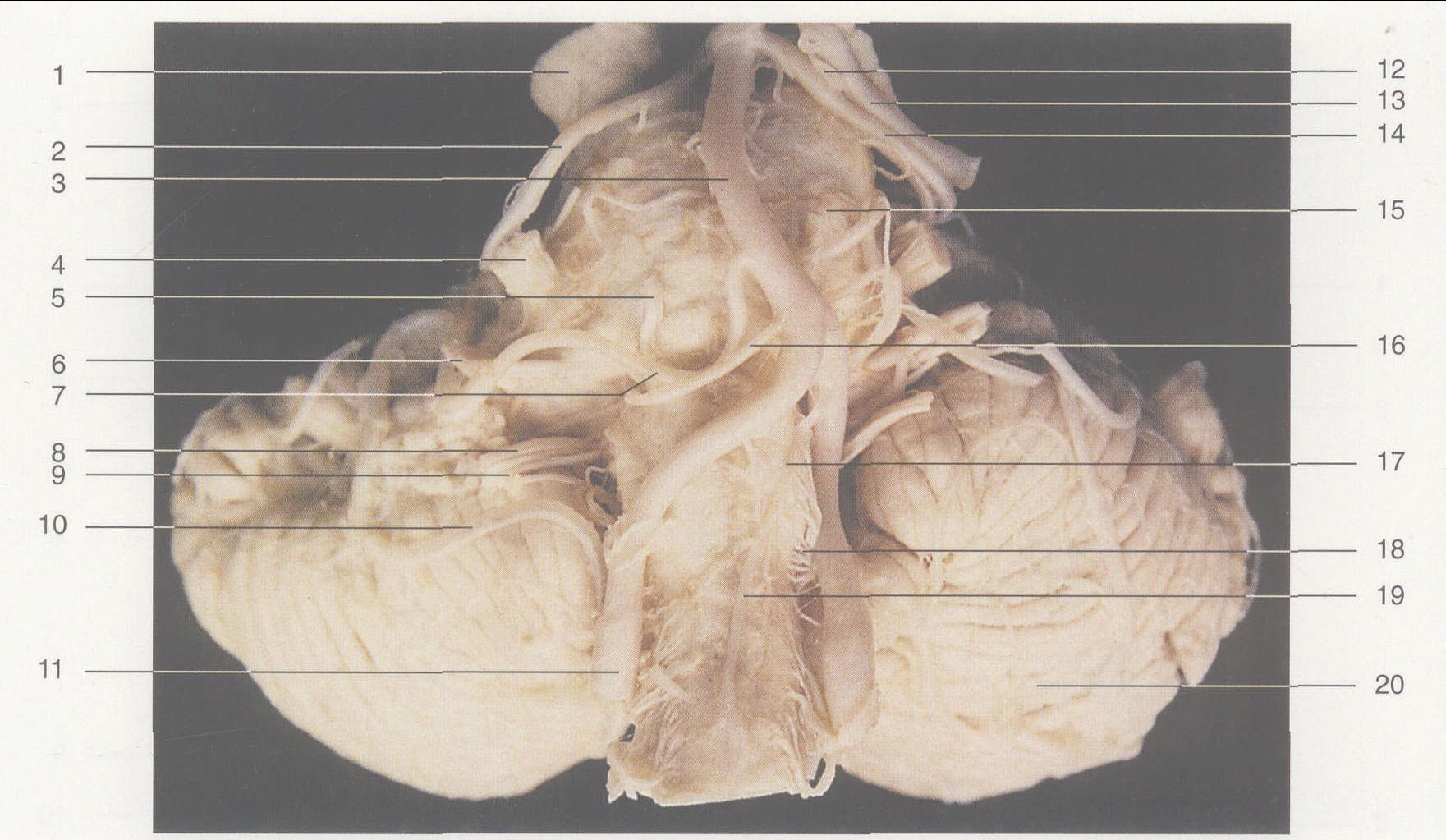图2—27 小脑及脑干 (腹侧观)