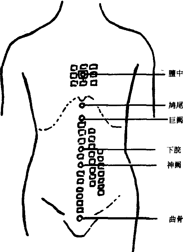 大灸療法