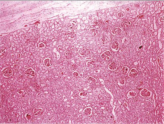 图11-1 肾皮质
