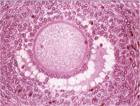 图12-2 次级卵泡
