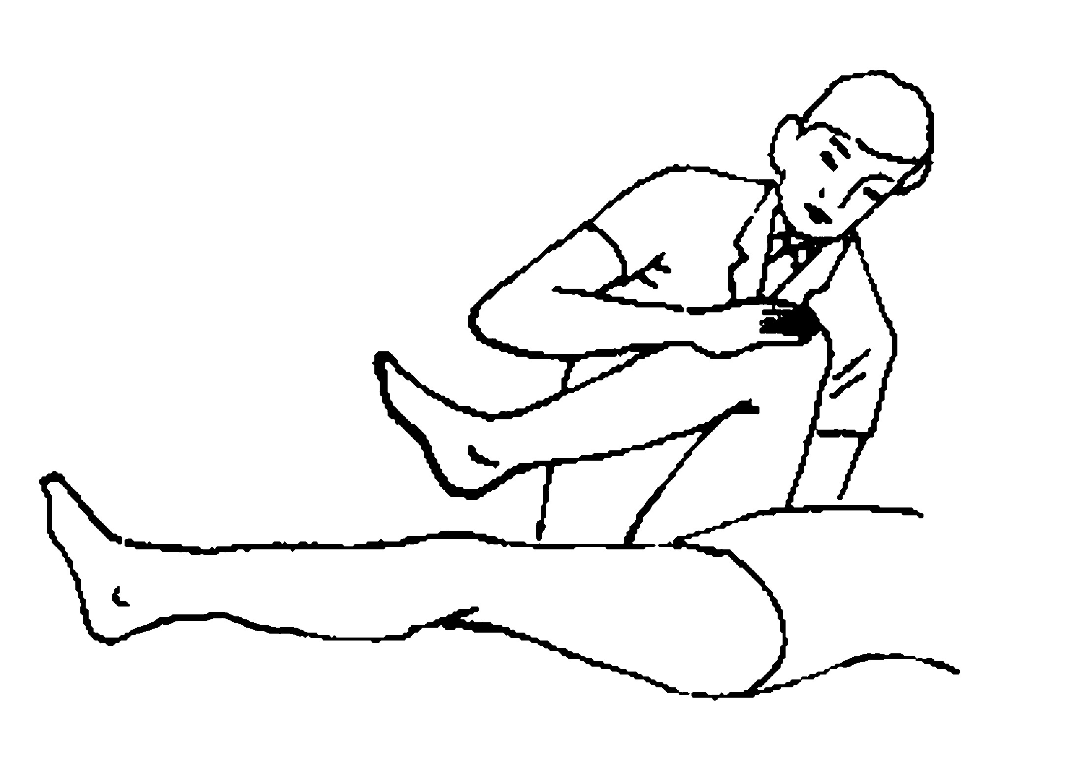 第五節(jié)　扳髖法及骶髂關(guān)節(jié)扳法