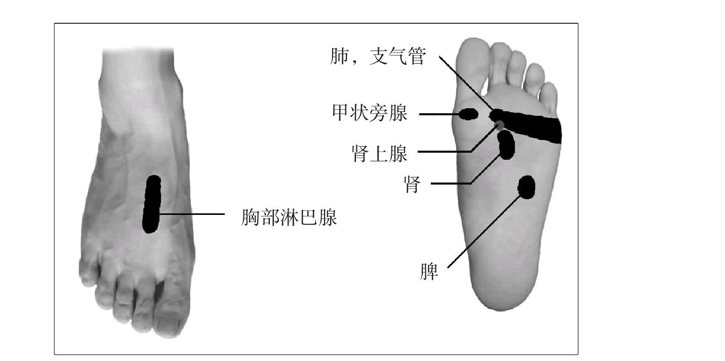 第三节 慢性支气管炎