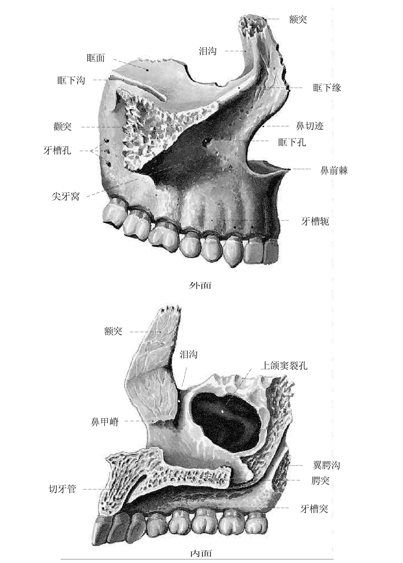 上颌骨(内面观)-人体解剖标本-医学