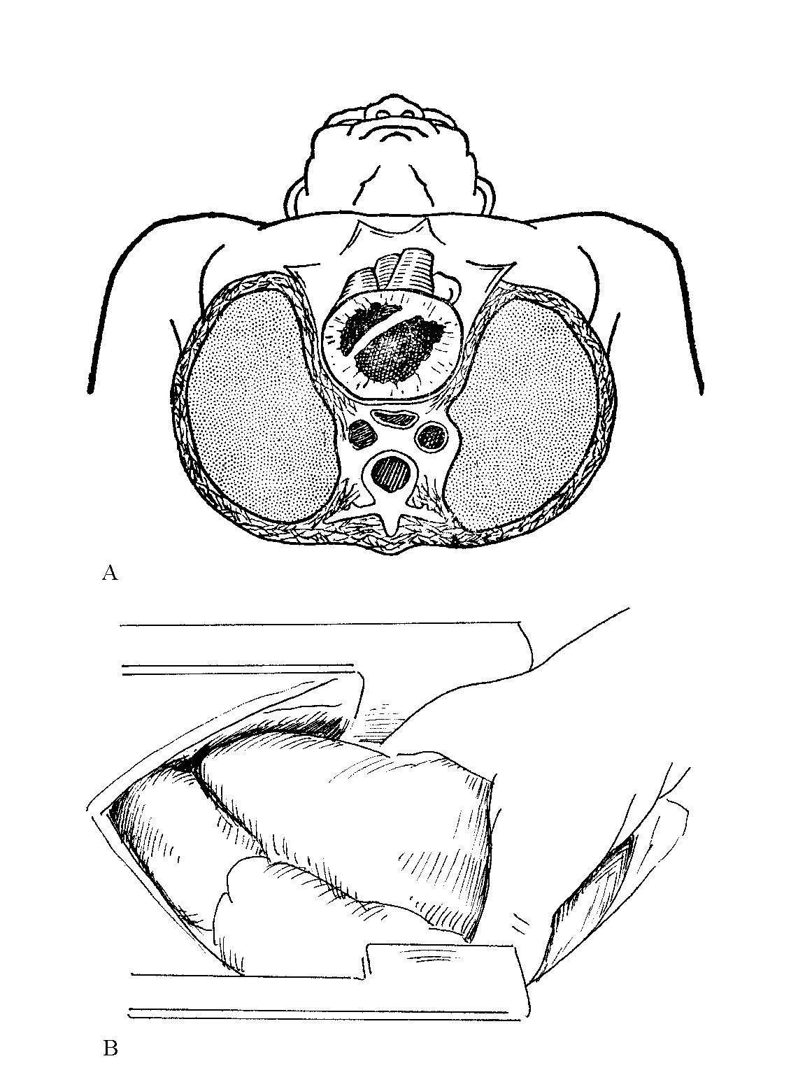 图2-5　A为经胸骨中部的横断面，心脏位于胸骨下方，位置表浅；