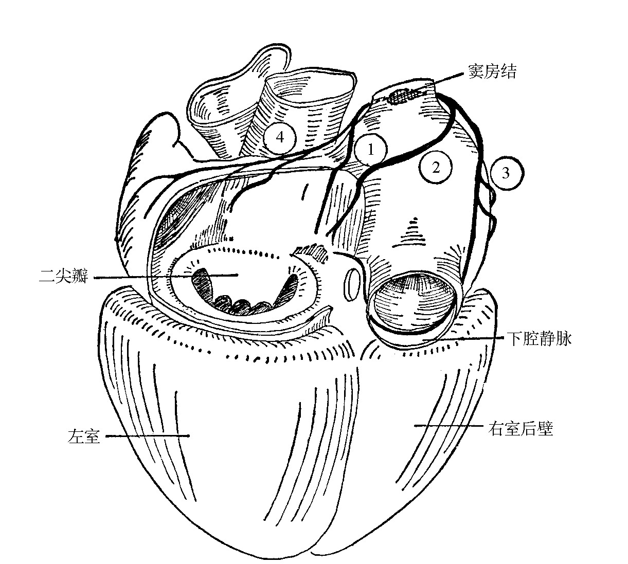 ①前结间束;②中结间束;③后结间束;④bachman束窦房结位于上腔静脉和