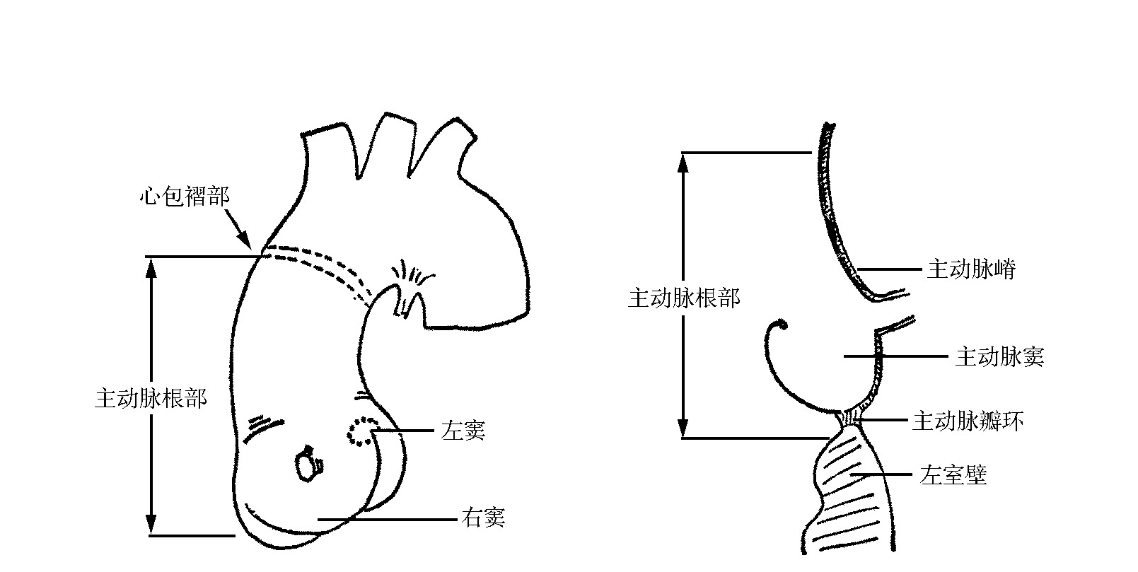 图9-1　主动脉根部的组成