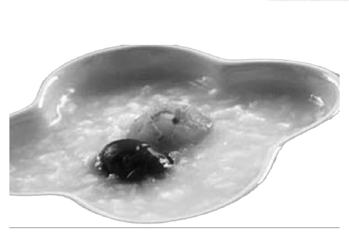 (四)龍眼肉的應(yīng)用與配伍