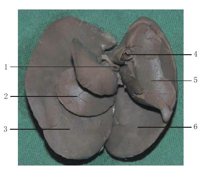 图4-8 肝脏面分叶