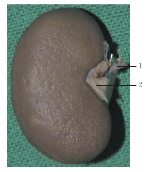 图4-22 肾脏外观