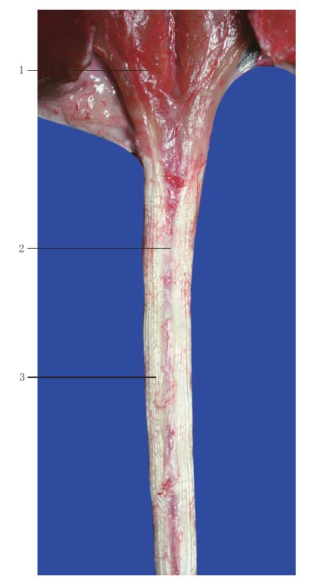 图9-2 尾腹侧血管鞘