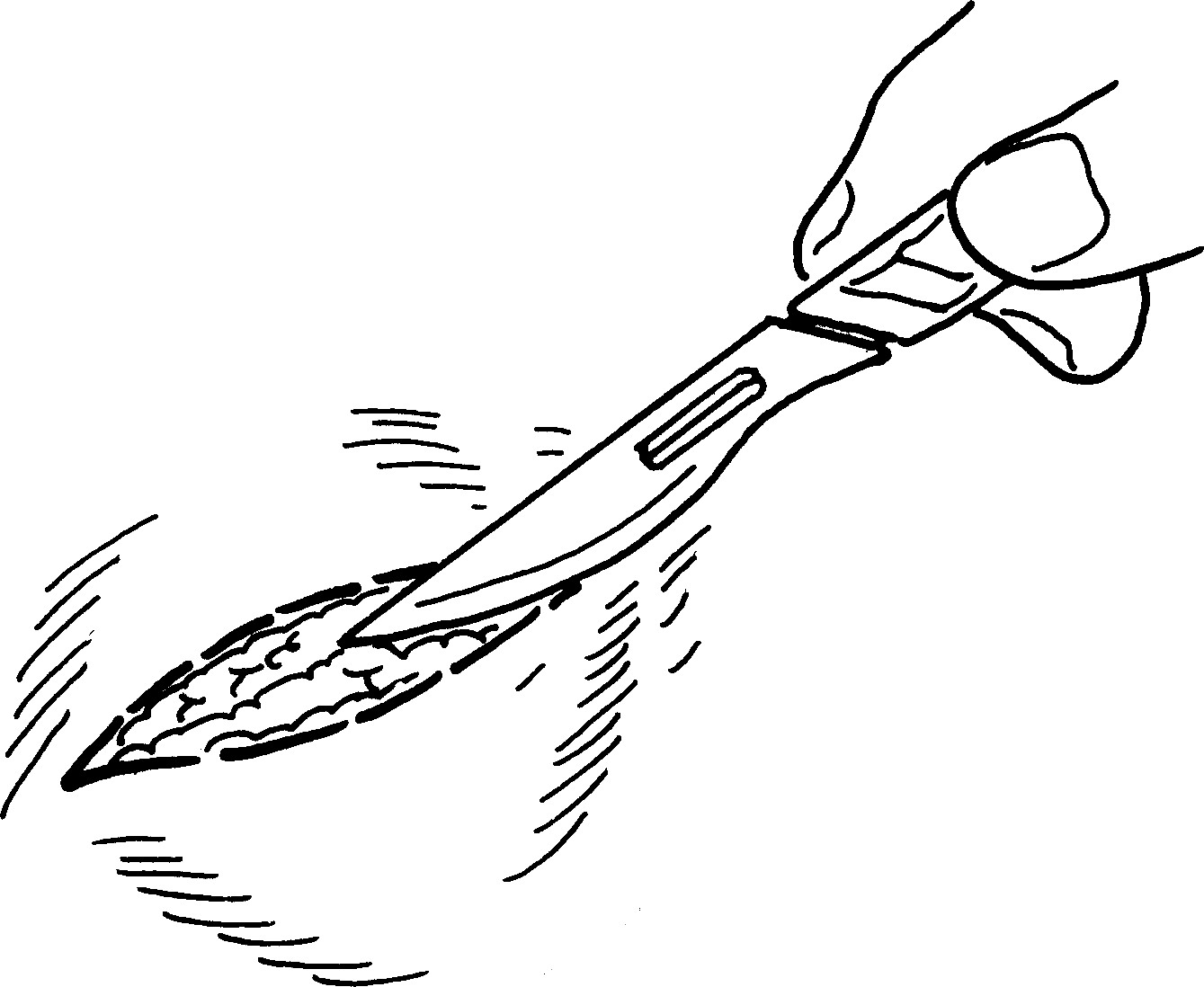 第五節(jié) 體表腫塊切除術(shù)