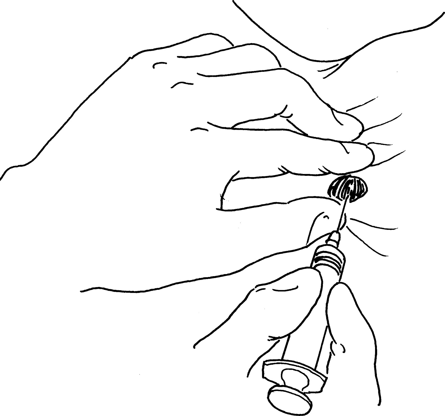 一、甲狀腺細(xì)針穿刺抽吸細(xì)胞學(xué)檢查
