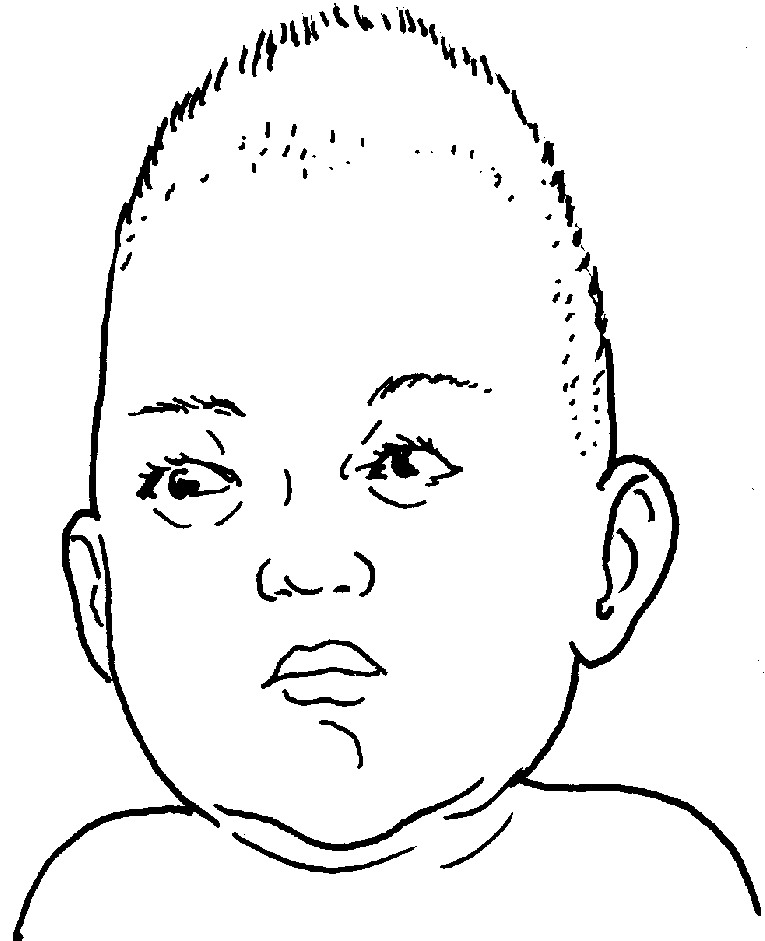 常見的頭顱畸形