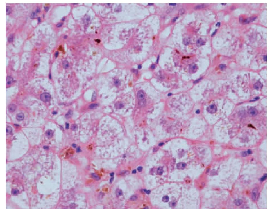 蟾蜍肝脏细胞手绘图图片