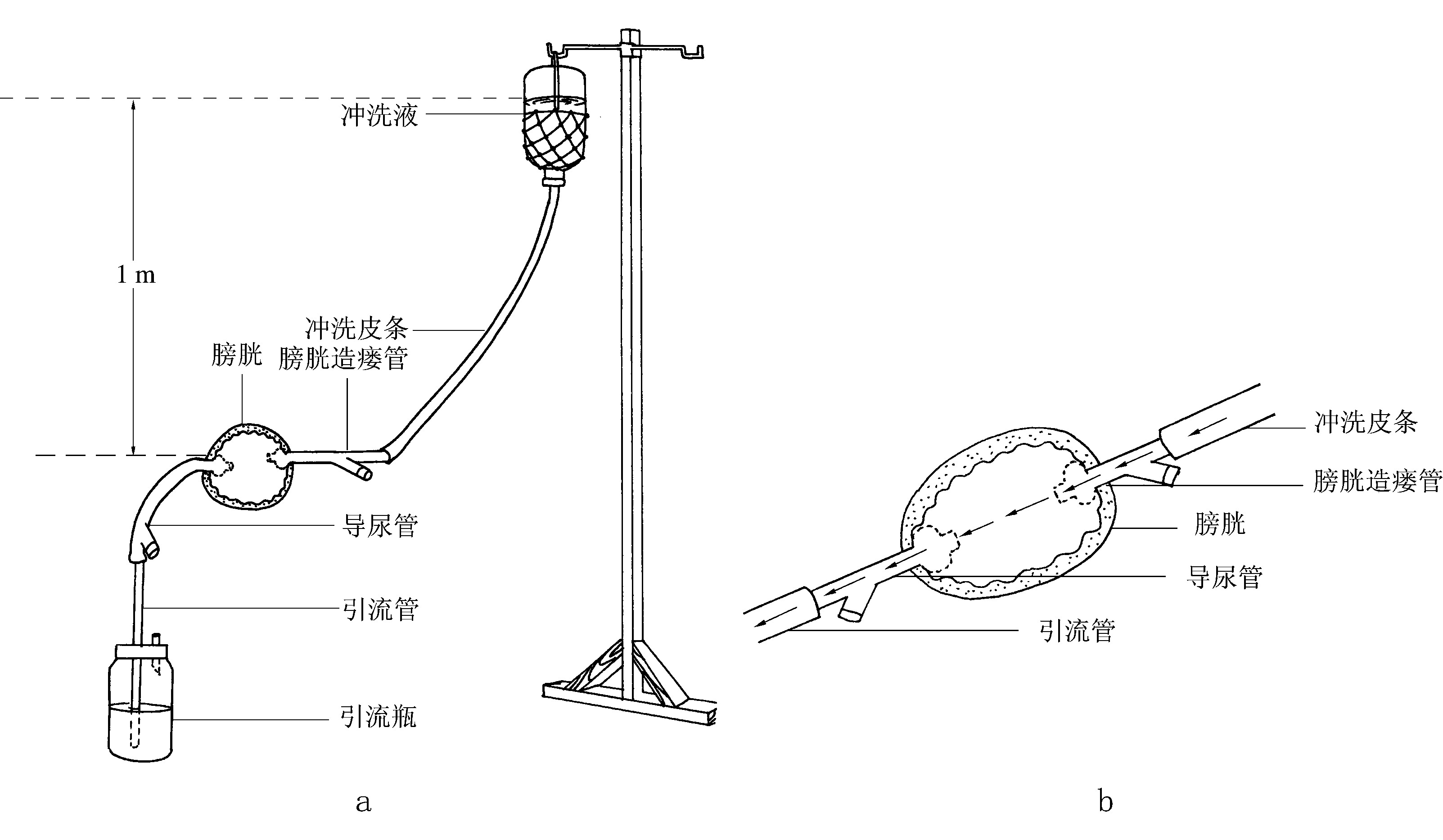 一次性使用膀胱冲洗器-产品中心-江西青山堂医疗器械有限公司