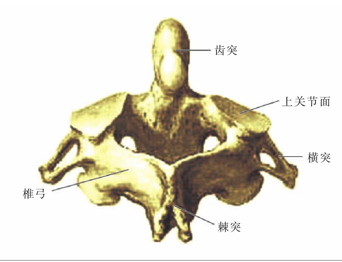 图5 枢椎（后面观）