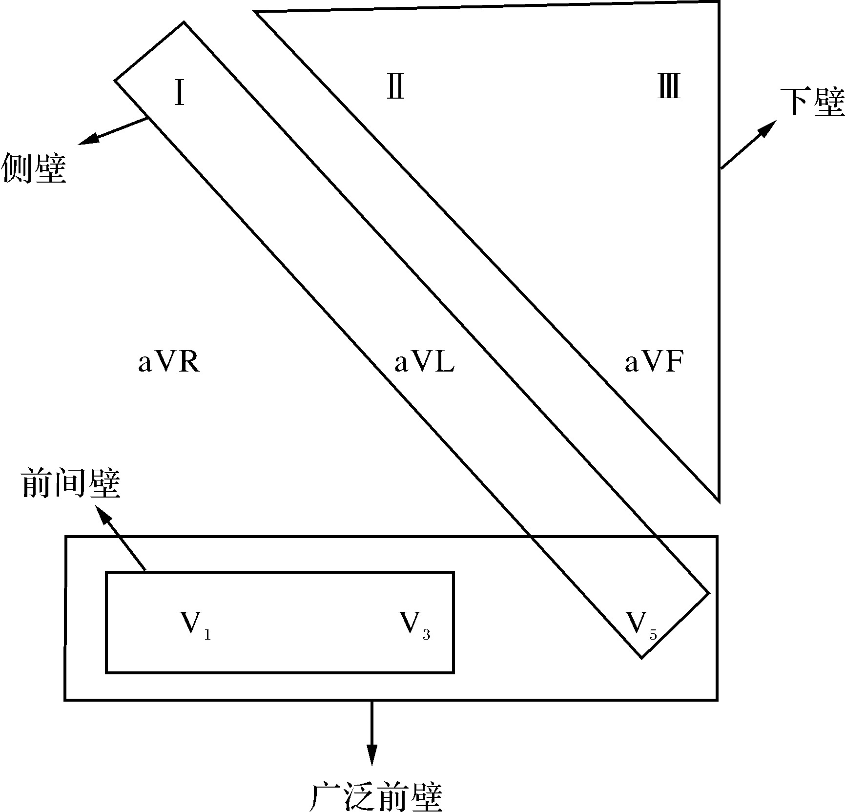 第六章　ST段抬高急性冠脈綜合征的監(jiān)護治療