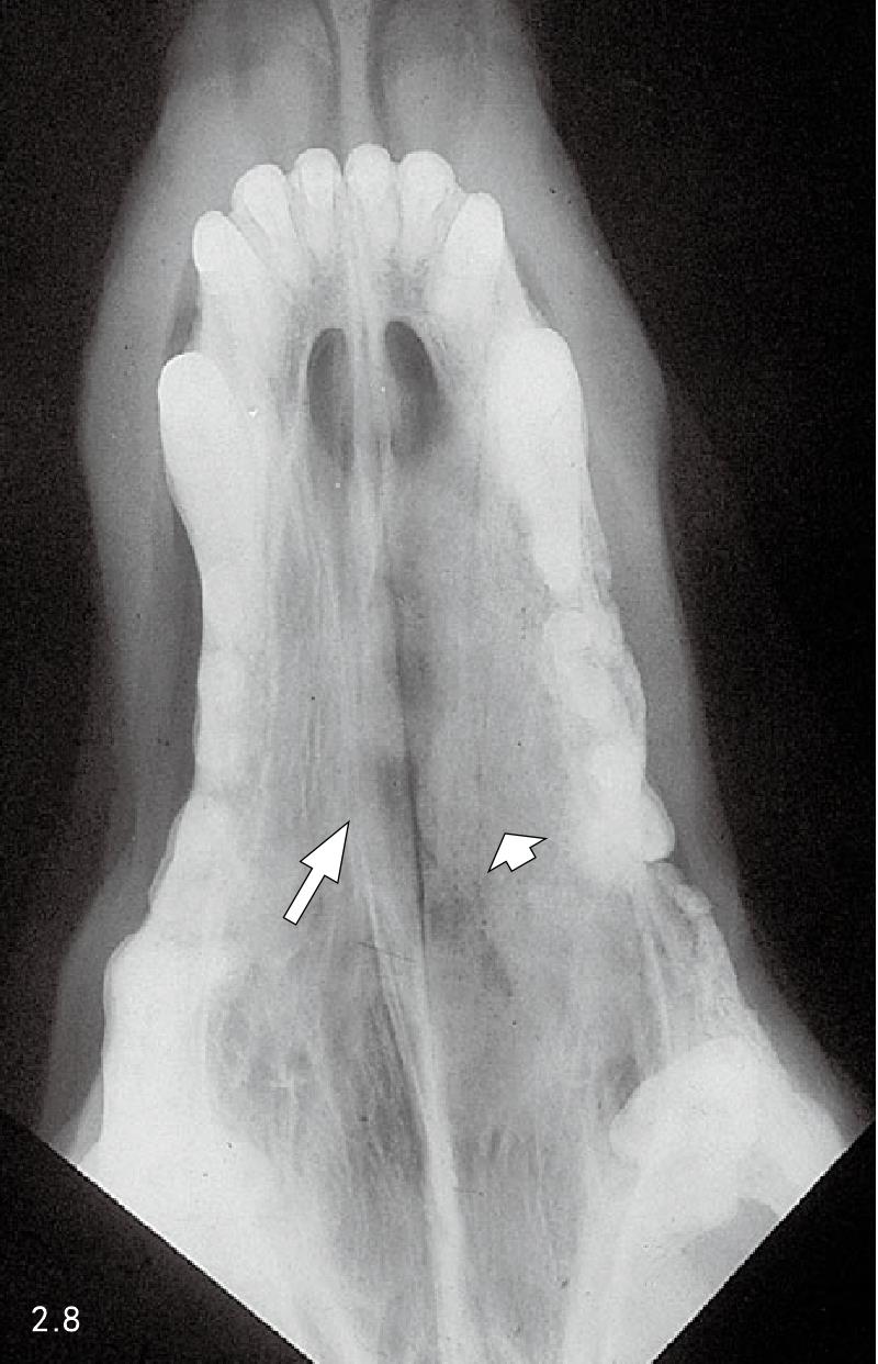 5. 鼻腔內(nèi)腫瘤