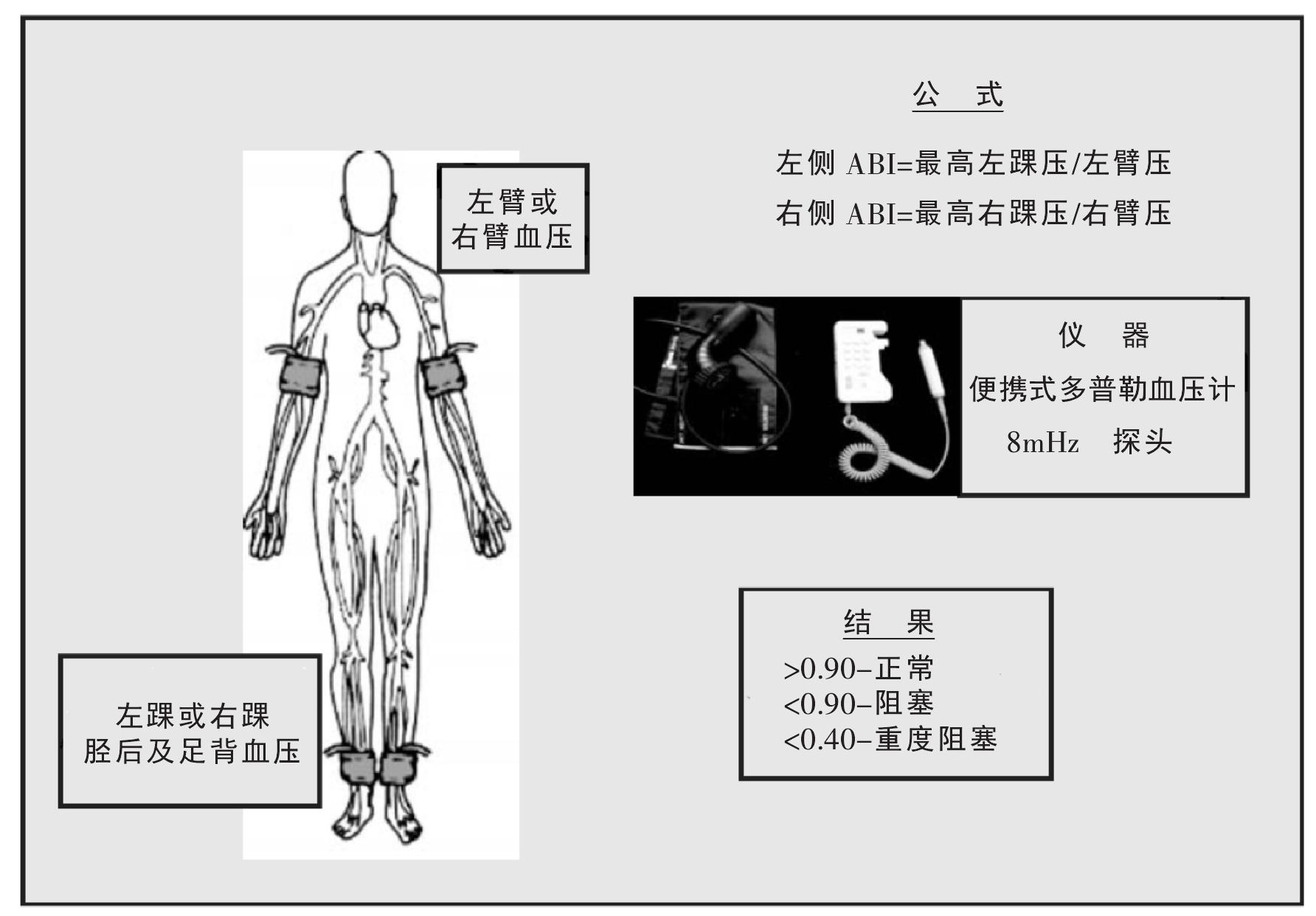 4.2 外周血管疾病的流行病學(xué)