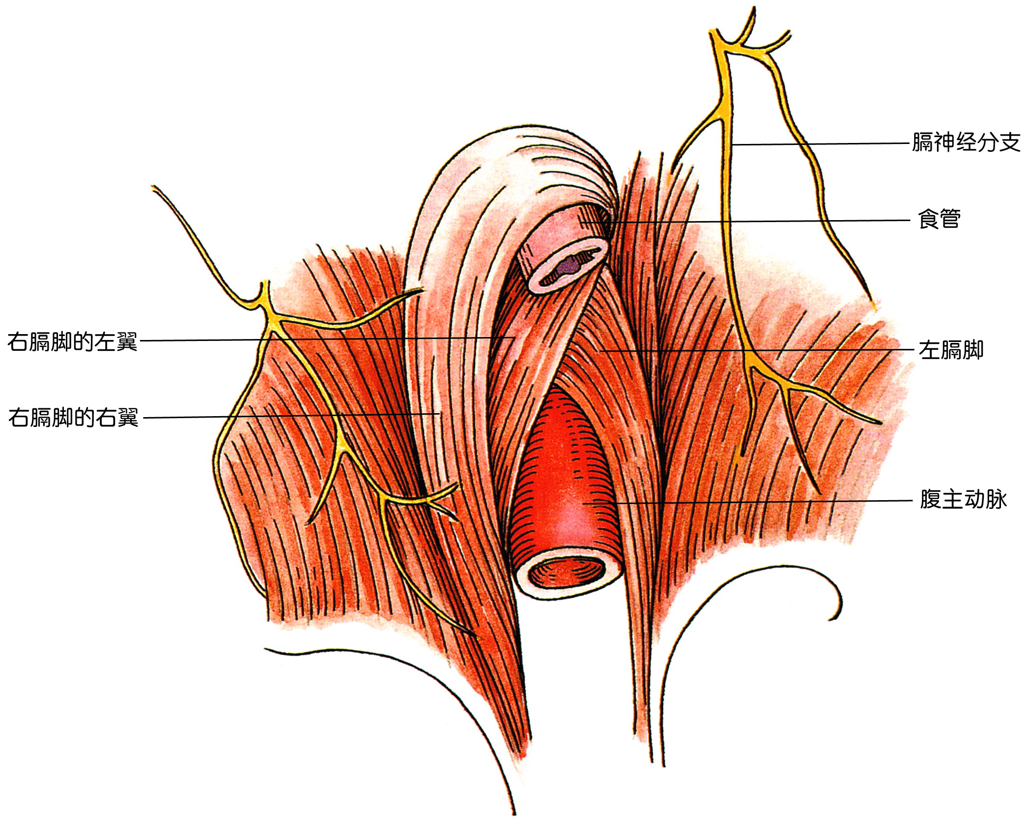 的一部分经食管裂孔进入胸腔,称为食管裂孔疝(esophagealhiatalhenia)