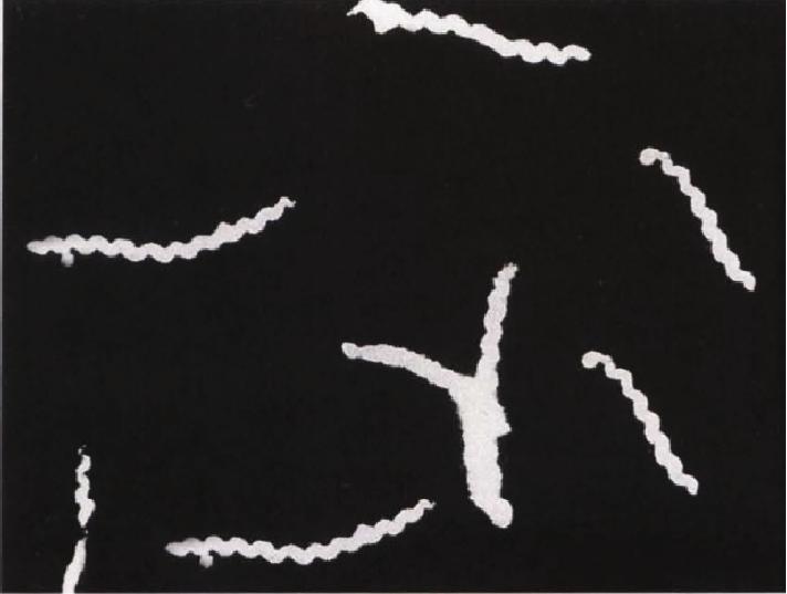 奋森氏螺旋体形态图片