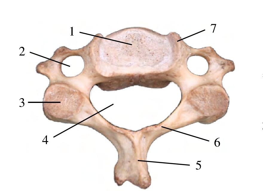 图1-4 颈椎(上面观)