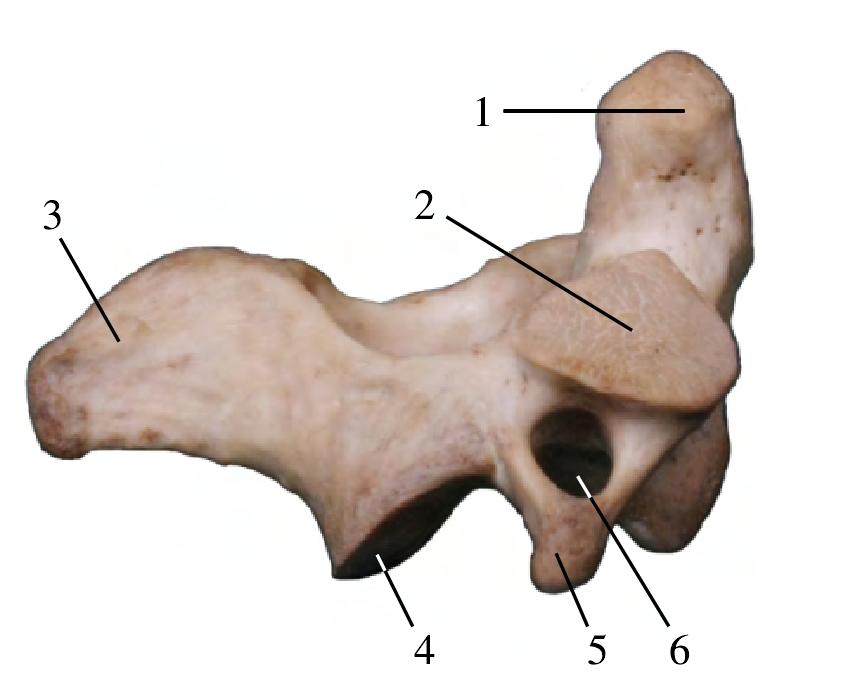 图1-7 枢椎(侧面观)