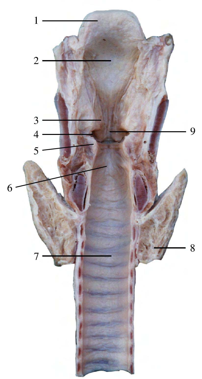喉室解剖图图片