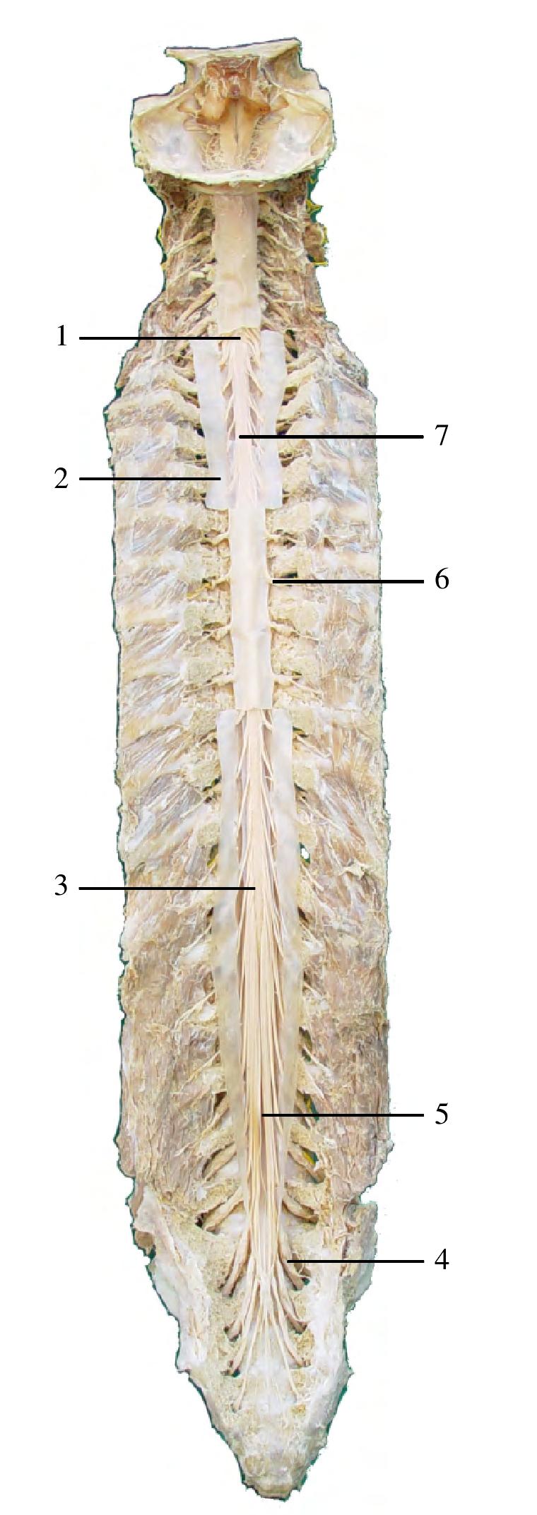 图5-2 原位脊髓全貌(后面观)