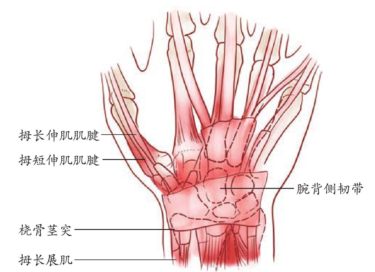 腕关节腱鞘炎解剖图图片