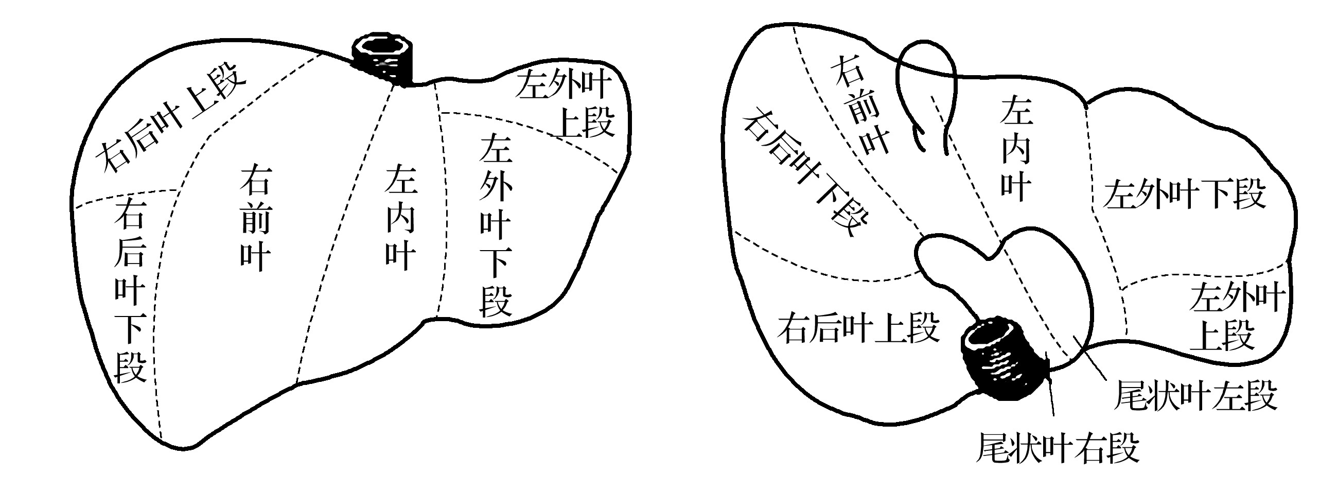 三、肝臟的分葉、分段