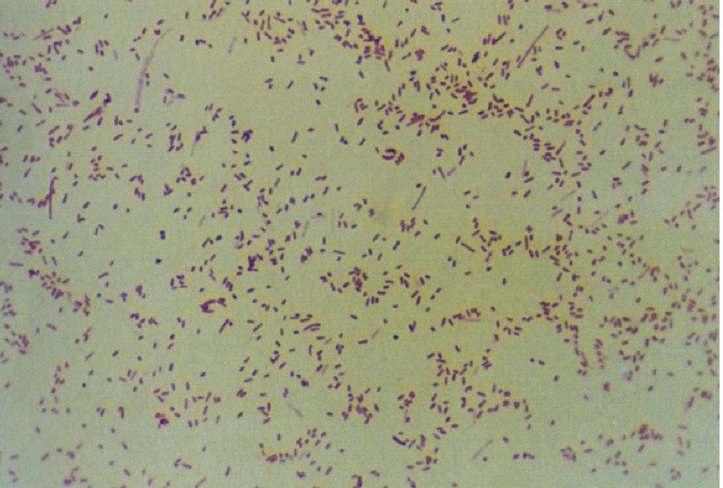 （十一）绵羊沙门杆菌性流产