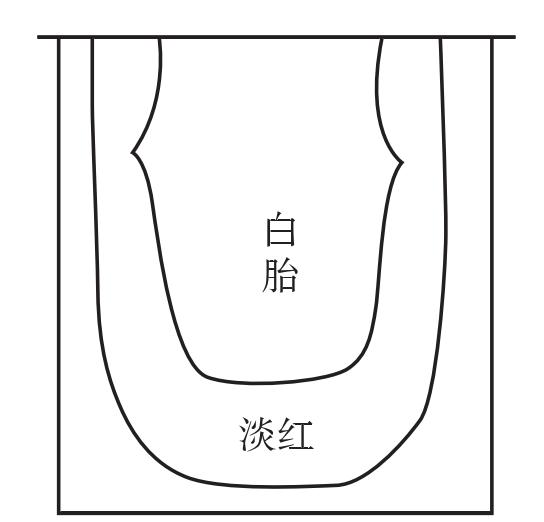白胎舌