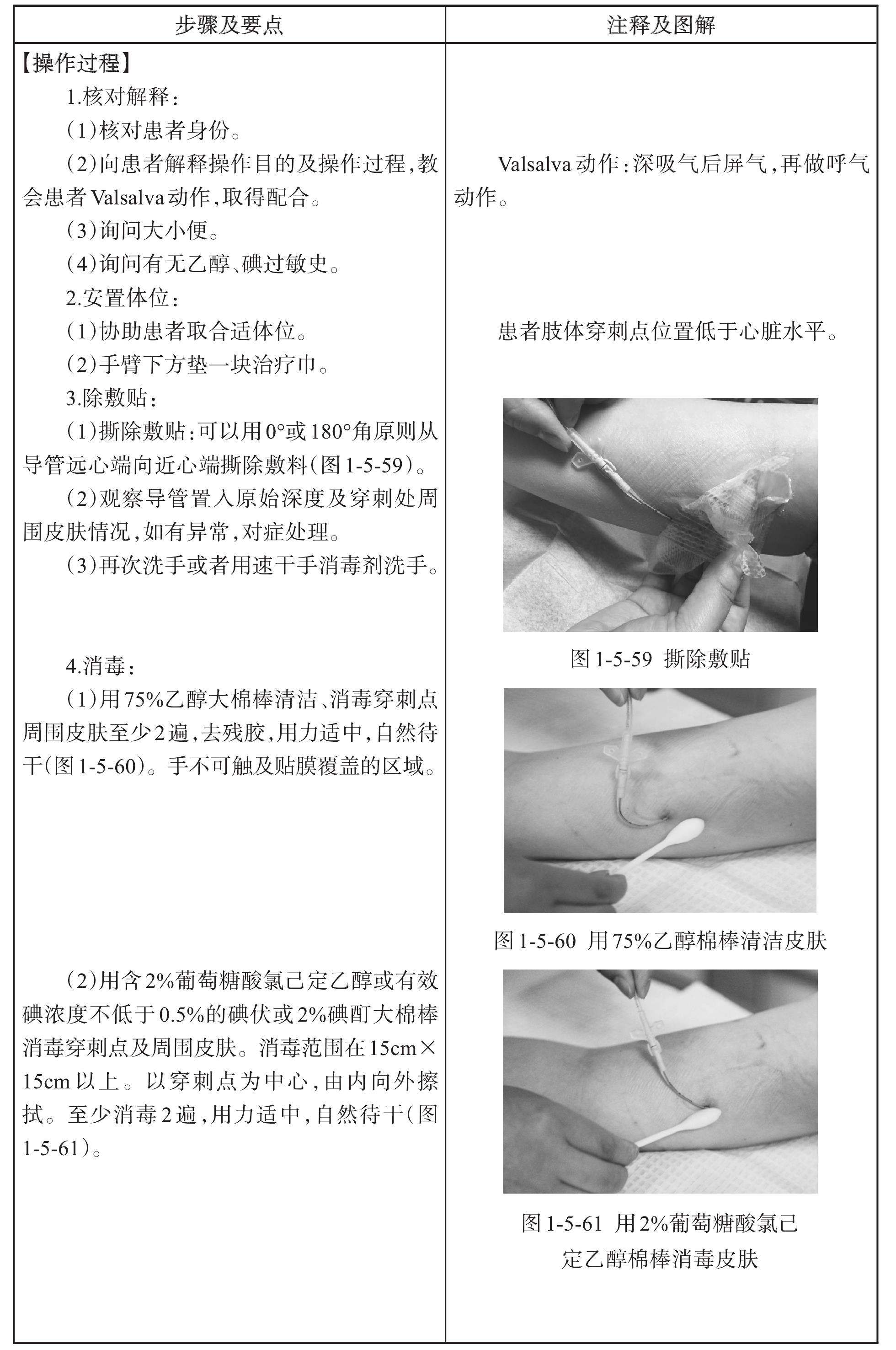 PICC 置管拔除操作