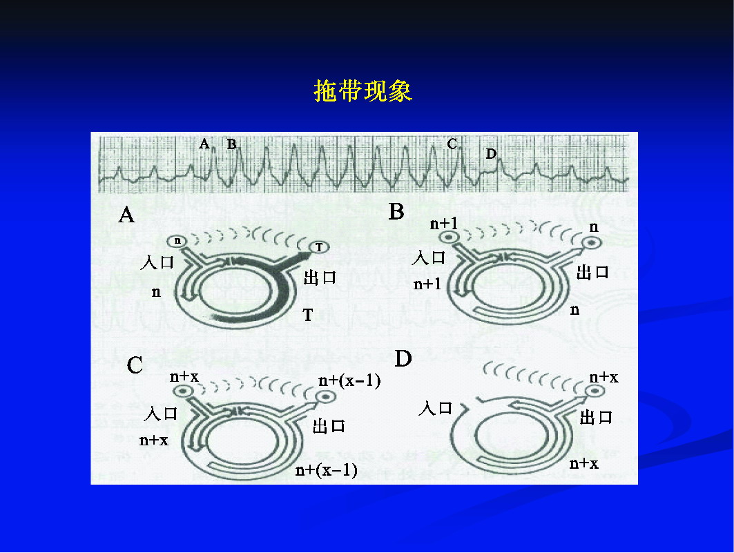 四、拖帶現(xiàn)象